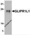 GLIPR1 Like 1 antibody, 7625, ProSci, Western Blot image 