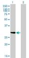 Nuclear Receptor Binding Protein 2 antibody, H00340371-M01, Novus Biologicals, Western Blot image 