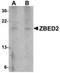 Zinc Finger BED-Type Containing 2 antibody, TA306759, Origene, Western Blot image 