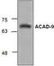 Acyl-CoA Dehydrogenase Family Member 9 antibody, TA318884, Origene, Western Blot image 