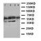 Parathyroid Hormone 1 Receptor antibody, orb107634, Biorbyt, Western Blot image 