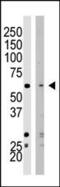 Lysine Methyltransferase 5A antibody, PA5-11277, Invitrogen Antibodies, Western Blot image 