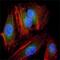 Mitogen-Activated Protein Kinase Kinase 2 antibody, GTX83358, GeneTex, Immunofluorescence image 