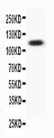 Progesterone Receptor antibody, PA1413, Boster Biological Technology, Western Blot image 