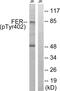 FER Tyrosine Kinase antibody, abx012599, Abbexa, Western Blot image 