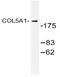 Collagen Type V Alpha 1 Chain antibody, AP20478PU-N, Origene, Western Blot image 