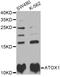 Antioxidant 1 Copper Chaperone antibody, STJ28954, St John