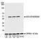 Enterokinase Cleavage Site tag antibody, A191-100, Bethyl Labs, Western Blot image 