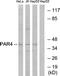 F2R Like Thrombin Or Trypsin Receptor 3 antibody, LS-C121021, Lifespan Biosciences, Western Blot image 