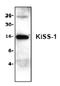 KiSS-1 Metastasis Suppressor antibody, AP00261PU-N, Origene, Western Blot image 