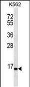 Serine Peptidase Inhibitor, Kazal Type 8 (Putative) antibody, PA5-48404, Invitrogen Antibodies, Western Blot image 