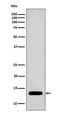 Profilin 1 antibody, M01480, Boster Biological Technology, Western Blot image 