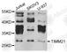 Translocase Of Inner Mitochondrial Membrane 21 antibody, A8209, ABclonal Technology, Western Blot image 