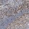 FYN Proto-Oncogene, Src Family Tyrosine Kinase antibody, NBP1-82685, Novus Biologicals, Immunohistochemistry paraffin image 