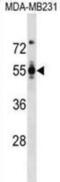 Podocalyxin Like antibody, abx030705, Abbexa, Western Blot image 