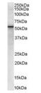 Vacuolar Protein Sorting 45 Homolog antibody, orb19103, Biorbyt, Western Blot image 