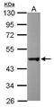 Dynactin Subunit 2 antibody, PA5-30389, Invitrogen Antibodies, Western Blot image 