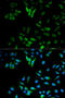 Enolase 1 antibody, STJ23538, St John