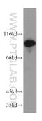 Advillin antibody, 20956-1-AP, Proteintech Group, Western Blot image 