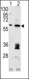 MDM2 Proto-Oncogene antibody, PA5-11353, Invitrogen Antibodies, Western Blot image 