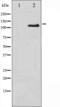 Integrin Subunit Beta 3 antibody, abx011021, Abbexa, Western Blot image 