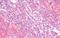 CD49D antibody, NB110-55525, Novus Biologicals, Immunohistochemistry paraffin image 