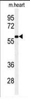 Terminal Nucleotidyltransferase 2 antibody, PA5-25015, Invitrogen Antibodies, Western Blot image 