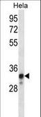 NADH dehydrogenase [ubiquinone] iron-sulfur protein 8, mitochondrial antibody, LS-C164814, Lifespan Biosciences, Western Blot image 