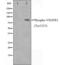 Fms Related Tyrosine Kinase 1 antibody, abx011296, Abbexa, Western Blot image 