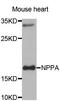 Natriuretic Peptide A antibody, TA327098, Origene, Western Blot image 