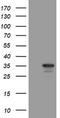 Metabolism Of Cobalamin Associated C antibody, LS-C174084, Lifespan Biosciences, Western Blot image 
