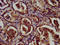 LRAT Domain Containing 1 antibody, LS-C672498, Lifespan Biosciences, Immunohistochemistry paraffin image 