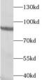 Transglutaminase 5 antibody, FNab08652, FineTest, Western Blot image 