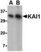 CD82 Molecule antibody, PA5-20356, Invitrogen Antibodies, Western Blot image 