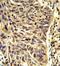 Small Nuclear Ribonucleoprotein D1 Polypeptide antibody, GTX81985, GeneTex, Immunohistochemistry paraffin image 