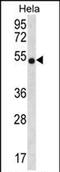 Chitinase 3 Like 2 antibody, PA5-71775, Invitrogen Antibodies, Western Blot image 