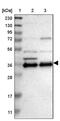 Chondroadherin antibody, PA5-53761, Invitrogen Antibodies, Western Blot image 