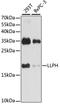 LLP Homolog, Long-Term Synaptic Facilitation Factor antibody, GTX66393, GeneTex, Western Blot image 