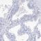 Myozenin 2 antibody, HPA035764, Atlas Antibodies, Immunohistochemistry frozen image 