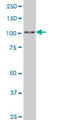 Spalt Like Transcription Factor 4 antibody, LS-C105164, Lifespan Biosciences, Western Blot image 