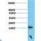 Transthyretin antibody, LS-C813246, Lifespan Biosciences, Western Blot image 
