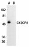 C-X3-C Motif Chemokine Receptor 1 antibody, TA306015, Origene, Western Blot image 