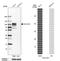Collagen Type XIII Alpha 1 Chain antibody, HPA050392, Atlas Antibodies, Western Blot image 