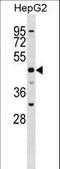 Solute carrier family 2, facilitated glucose transporter member 9 antibody, LS-C161212, Lifespan Biosciences, Western Blot image 