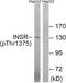 Insulin Receptor antibody, 79-848, ProSci, Western Blot image 