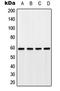 Probable G-protein coupled receptor 75 antibody, GTX55193, GeneTex, Western Blot image 