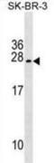 Trafficking Regulator Of GLUT4 (SLC2A4) 1 antibody, abx029882, Abbexa, Western Blot image 