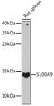 S100 Calcium Binding Protein A9 antibody, GTX64397, GeneTex, Western Blot image 