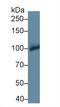 Glycogen Phosphorylase B antibody, LS-C294285, Lifespan Biosciences, Western Blot image 