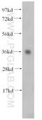 Coenzyme Q9 antibody, 14874-1-AP, Proteintech Group, Western Blot image 